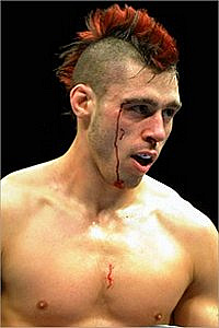 Dan Hardy